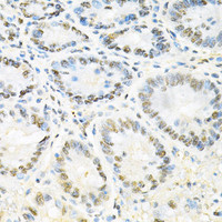 Immunohistochemistry of paraffin-embedded Mouse stomach using SNRPE Polyclonal Antibody at dilution of 1:200 (40x lens) .