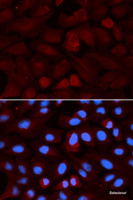 Immunofluorescence analysis of U2OS cells using ALDH3A1 Polyclonal Antibody