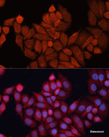 Immunofluorescence analysis of HeLa cells using DNAJB1 Polyclonal Antibody at dilution of 1:100. Blue: DAPI for nuclear staining.