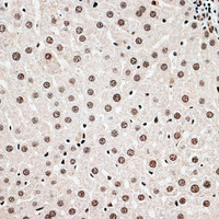 Immunohistochemistry of paraffin-embedded Rat liver using CBX6 Polyclonal Antibody at dilution of 1:100 (40x lens) .