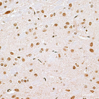 Immunohistochemistry of paraffin-embedded Rat brain using CBX6 Polyclonal Antibody at dilution of 1:100 (40x lens) .