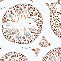 Immunohistochemistry of paraffin-embedded Mouse testis using CBX6 Polyclonal Antibody at dilution of 1:100 (40x lens) .
