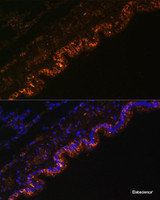 Immunofluorescence analysis of Rat lung cells using SCNN1A Polyclonal Antibody at dilution of 1:100. Blue: DAPI for nuclear staining.