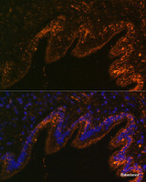 Immunofluorescence analysis of Rat lung cells using SCNN1A Polyclonal Antibody at dilution of 1:100. Blue: DAPI for nuclear staining.