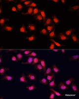 Immunofluorescence analysis of HeLa cells using PRDM14 Polyclonal Antibody at dilution of 1:100. Blue: DAPI for nuclear staining.