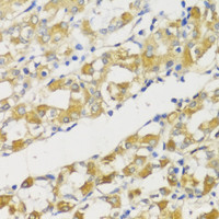 Immunohistochemistry of paraffin-embedded Human stomach using Snail Polyclonal Antibody at dilution of 1:100 (40x lens) .