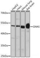 Western blot analysis of extracts of various cell lines using GNAS Polyclonal Antibody at dilution of 1:1000.