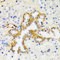 Immunohistochemistry of paraffin-embedded Rat kidney using SH2B1 Polyclonal Antibody at dilution of 1:100 (40x lens) .