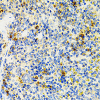 Immunohistochemistry of paraffin-embedded Mouse spleen using SH2B1 Polyclonal Antibody at dilution of 1:100 (40x lens) .
