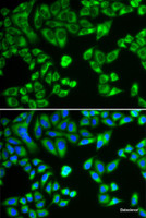 Immunofluorescence analysis of HeLa cells using SH2B1 Polyclonal Antibody