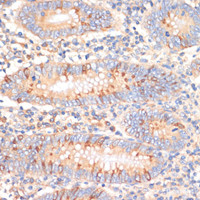 Immunohistochemistry of paraffin-embedded Human appendix using WNK3 Polyclonal Antibody at dilution of 1:100 (40x lens) .