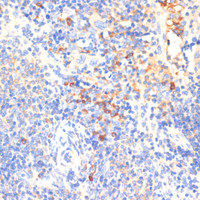 Immunohistochemistry of paraffin-embedded Mouse spleen using WNK3 Polyclonal Antibody at dilution of 1:100 (40x lens) .
