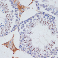 Immunohistochemistry of paraffin-embedded Mouse testis using SKIV2L2 Polyclonal Antibody at dilution of 1:100 (40x lens) .