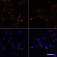 Immunofluorescence analysis of C6 cells using LC3B Polyclonal Antibody at dilution of 1:100. C6 cells were treated by Chloroquine (50 μM) for 20 hours (left) . Blue: DAPI for nuclear staining.