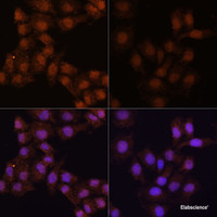 Immunofluorescence analysis of HeLa cells using LC3B Polyclonal Antibody at dilution of 1:100. Hela cells were treated by Chloroquine (50 μM) for 20 hours (left) . Blue: DAPI for nuclear staining.