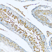 Immunohistochemistry of paraffin-embedded Rat testis using HPX Polyclonal Antibody at dilution of 1:100 (20x lens) .