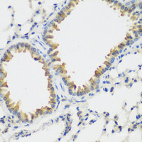 Immunohistochemistry of paraffin-embedded Mouse lung using FLT4 Polyclonal Antibody at dilution of 1:200 (40x lens) .