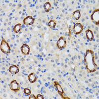Immunohistochemistry of paraffin-embedded Rat kidney using GABARAP Polyclonal Antibody at dilution of 1:100 (40x lens) .