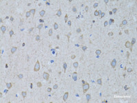 Immunohistochemistry of paraffin-embedded Rat brain using GABARAP Polyclonal Antibody at dilution of 1:100 (40x lens) .