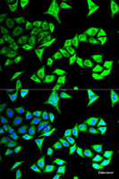 Immunofluorescence analysis of MCF-7 cells using GABARAP Polyclonal Antibody
