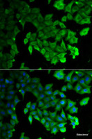 Immunofluorescence analysis of HeLa cells using LC3A/LC3B Polyclonal Antibody