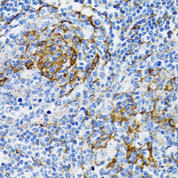 Immunohistochemistry of paraffin-embedded Human tonsil using PGRMC1 Polyclonal Antibody at dilution of 1:100 (40x lens) .