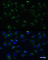 Immunofluorescence analysis of C6 cells using PGRMC1 Polyclonal Antibody at dilution of 1:100 (40x lens) . Blue: DAPI for nuclear staining.