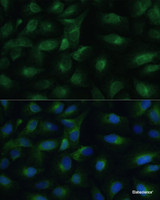 Immunofluorescence analysis of U-2 OS cells using PGRMC1 Polyclonal Antibody at dilution of 1:100 (40x lens) . Blue: DAPI for nuclear staining.