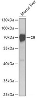 Western blot analysis of extracts of Mouse liver using C9 Polyclonal Antibody at dilution of 1:1000.