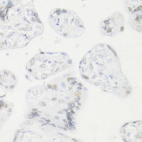 Immunohistochemistry of paraffin-embedded Human placenta using CREM Polyclonal Antibody at dilution of 1:100 (40x lens) .