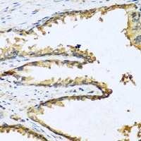 Immunohistochemistry of paraffin-embedded Human prostate using GNRH1 Polyclonal Antibody at dilution of 1:100 (40x lens) .