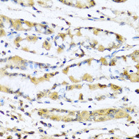 Immunohistochemistry of paraffin-embedded Human stomach using GNRH1 Polyclonal Antibody at dilution of 1:100 (40x lens) .