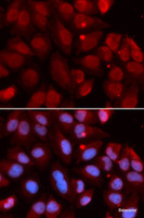 Immunofluorescence analysis of U2OS cells using RAG2 Polyclonal Antibody