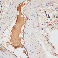 Immunohistochemistry of paraffin-embedded Human lung using APOC1 Polyclonal Antibody at dilution of 1:100 (40x lens) .