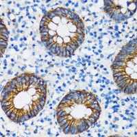 Immunohistochemistry of paraffin-embedded Human vermiform appendix using CTNNA1 Polyclonal Antibody at dilution of 1:100 (40x lens) .