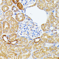 Immunohistochemistry of paraffin-embedded Mouse kidney using ECE1 Polyclonal Antibody at dilution of 1:100 (40x lens) .