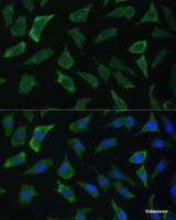 Immunofluorescence analysis of L929 cells using ECE1 Polyclonal Antibody at dilution of 1:100 (40x lens) . Blue: DAPI for nuclear staining.