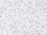 Immunohistochemistry of paraffin-embedded Human leiomyoma of uterus using FKBP4 Polyclonal Antibody at dilution of 1:100 (40x lens) .
