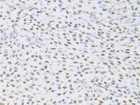 Immunohistochemistry of paraffin-embedded Human adenomyosis using FKBP4 Polyclonal Antibody at dilution of 1:100 (40x lens) .