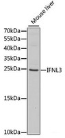 Western blot analysis of extracts of Mouse liver using IFNL3 Polyclonal Antibody at dilution of 1:1000.