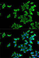 Immunofluorescence analysis of U2OS cells using HTR2B Polyclonal Antibody