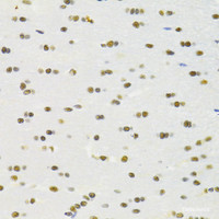 Immunohistochemistry of paraffin-embedded Rat brain using RBPJ Polyclonal Antibody at dilution of 1:100 (40x lens) .