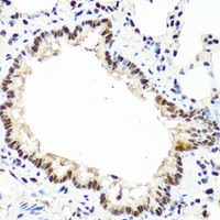 Immunohistochemistry of paraffin-embedded Rat lung using TET2 Polyclonal Antibody at dilution of 1:100 (40x lens) .