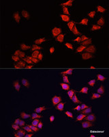 Immunofluorescence analysis of HeLa cells using BNIP3 Polyclonal Antibody at dilution of 1:100. Blue: DAPI for nuclear staining.