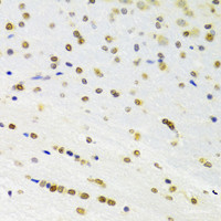 Immunohistochemistry of paraffin-embedded Rat brain using DOK1 Polyclonal Antibody at dilution of 1:100 (40x lens) .