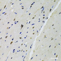 Immunohistochemistry of paraffin-embedded Mouse heart using DOK1 Polyclonal Antibody at dilution of 1:100 (40x lens) .