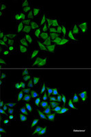 Immunofluorescence analysis of HeLa cells using DOK1 Polyclonal Antibody