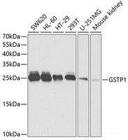 Western blot analysis of extracts of various cell lines using GSTP1 Polyclonal Antibody at dilution of 1:1000.