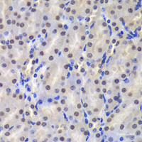Immunohistochemistry of paraffin-embedded Mouse kidney using GSTP1 Polyclonal Antibody at dilution of 1:200 (40x lens) .