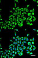 Immunofluorescence analysis of U2OS cells using GSTP1 Polyclonal Antibody